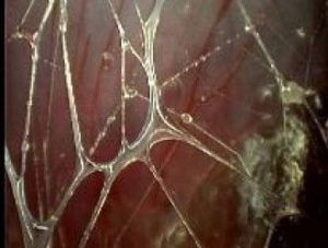 Connective tissue wrapping a muscle