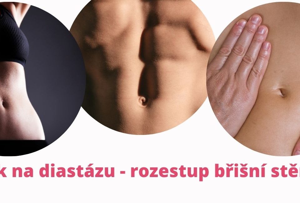 How to Heal Diastasis Recti: A Comprehensive Guide