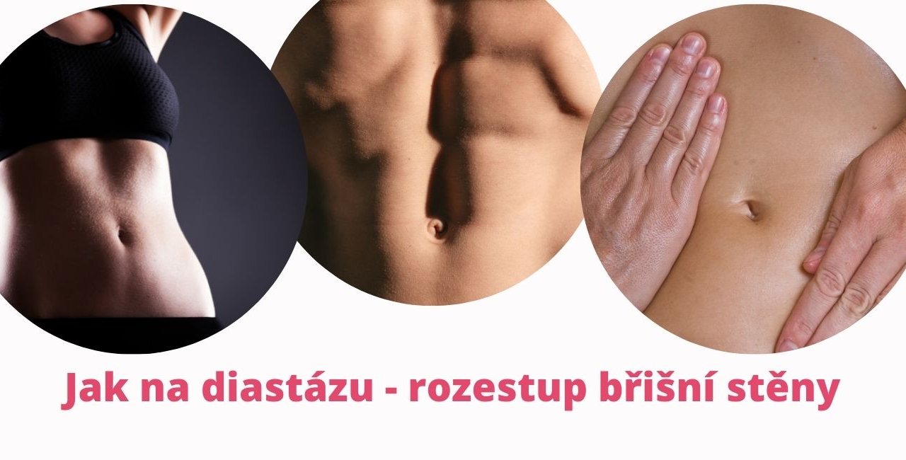How to Heal Diastasis Recti: A Comprehensive Guide