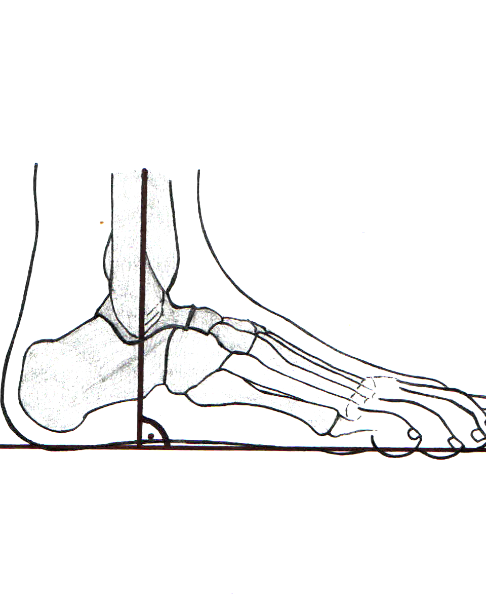 Anatomical drawing of the foot's bones