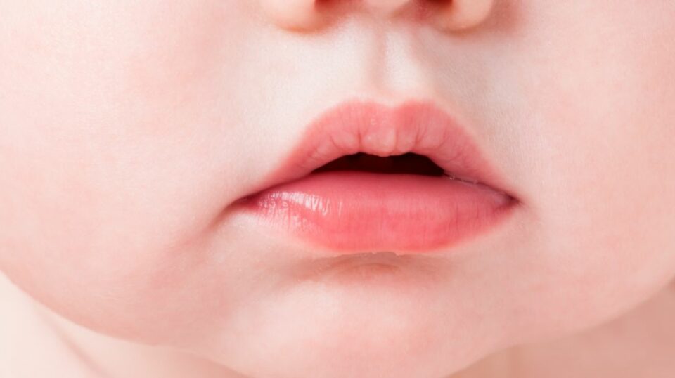 Image showing the difference in facial structure between nasal and mouth breathers.