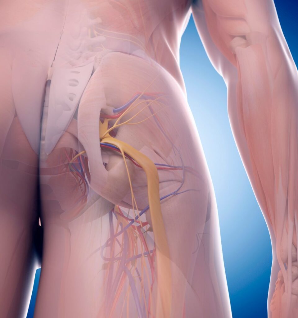 A graphic illustrating the location of the piriformis muscle and its relation to the sciatic nerve.