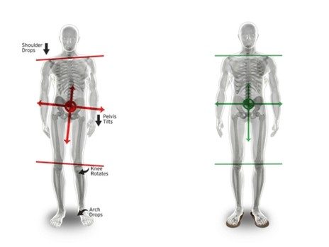 An illustration showing how posture affects the hip and SI joint.